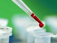 забор крови на биохимический анализ
