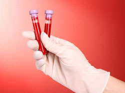 Анализ крови на гормоны пролактин, прогестерон