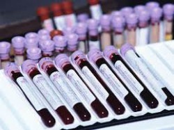 пробирки с анализом крови на гемостазиограмму