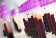 пробирки с кровью общий анализ крови