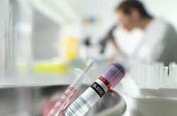 лаборатория и анализ крови на онкомаркеры