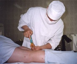 Трепан-биопсия — вид биопсии, при котором применяются специальные иглы, имеющие резьбу.