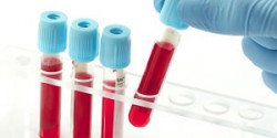 Подготовка общий анализ крови расшифровка thumbnail
