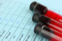 Биохимический анализ крови как читать онлайн thumbnail